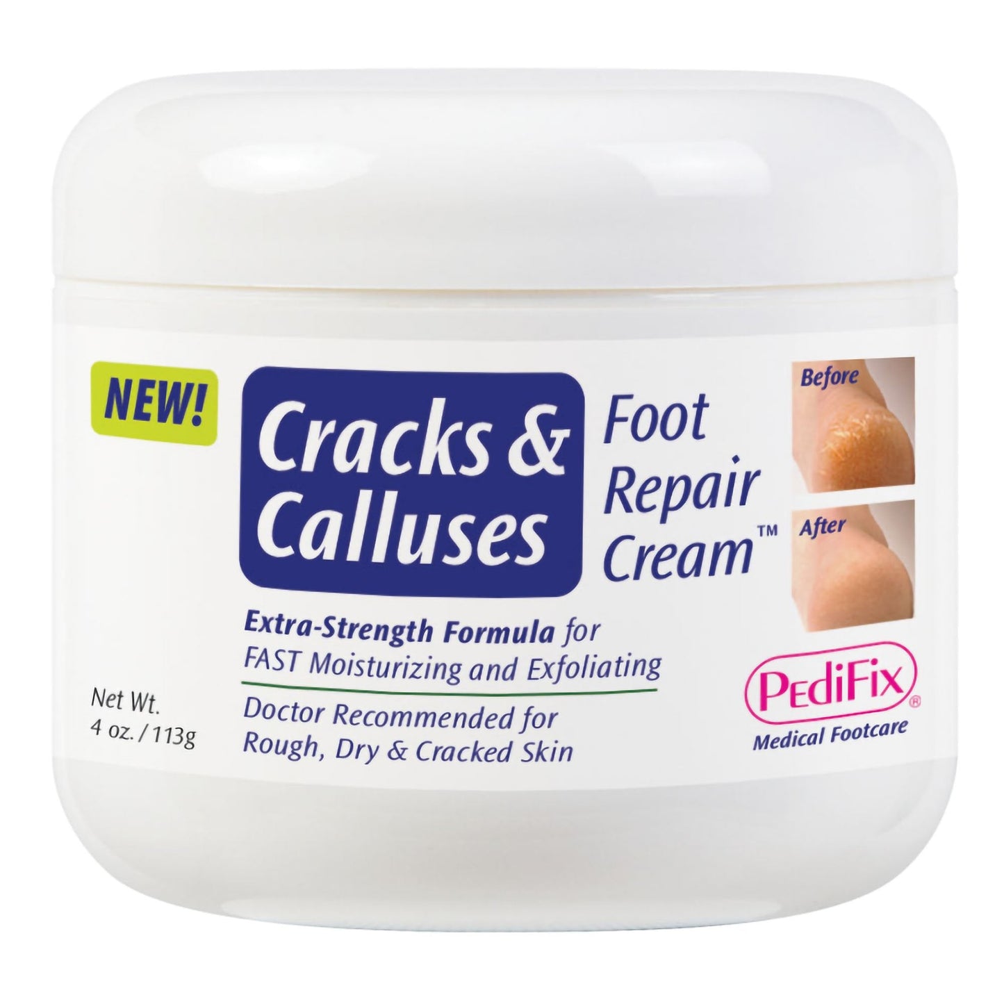 Pedifix Foot Moisturizer Cracks & Calluses 4 Oz. Jar Scented Cream MK