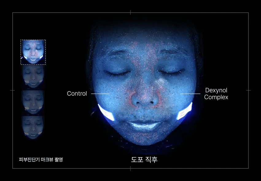 Dexynol-16.3 Acne-Line Trio Set - PROMOTION