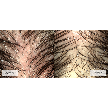 Rene Furterer Astera Fresh Soothing Freshness Concentrate (Pre-Shampoo) 50ml/1.6o