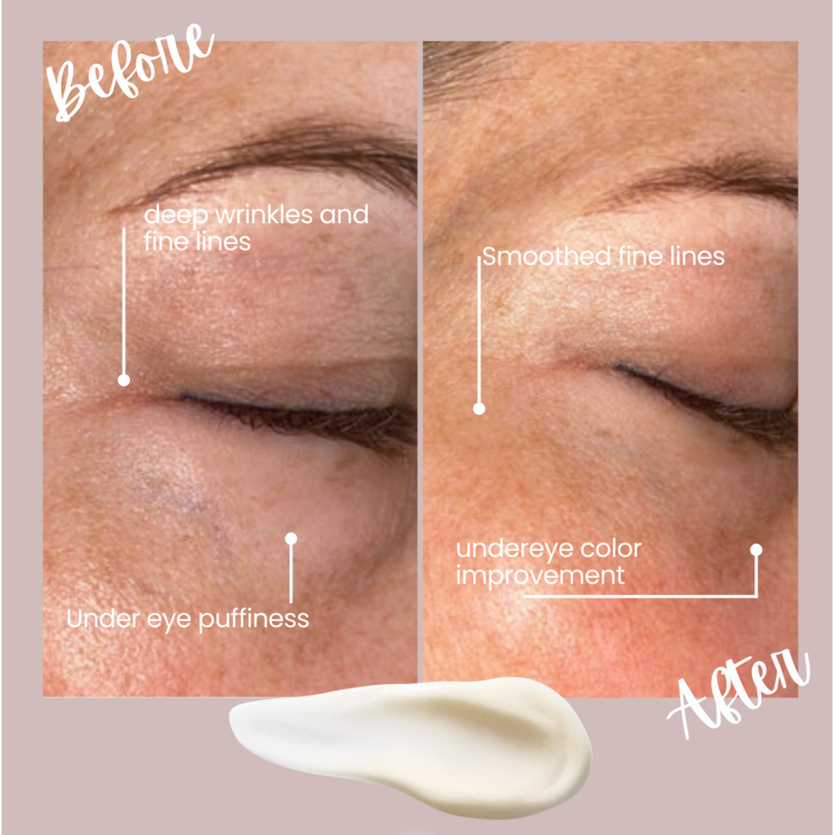 Radiance Renewal Eye Cream + NMF Complex