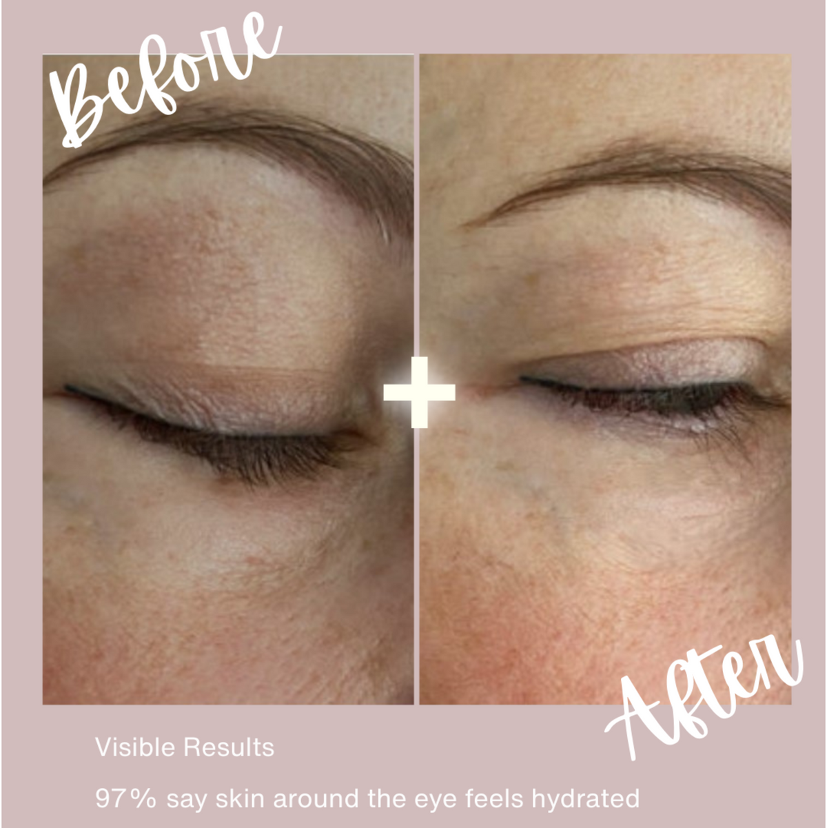 Radiance Renewal Eye Cream + NMF Complex