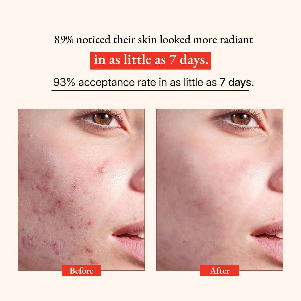 Glow Vitamin C Serum: Astaxanthin X Amla Oil (Tridoshic)