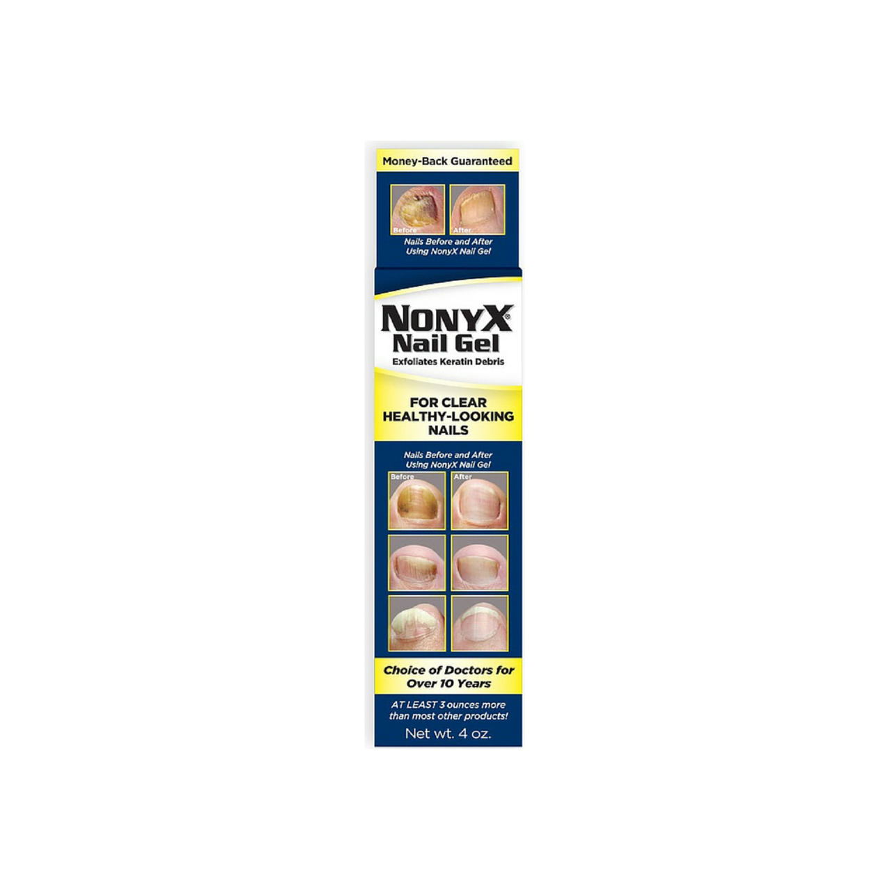Nonyx Fungal Nail Clarifying Gel, 4 Oz