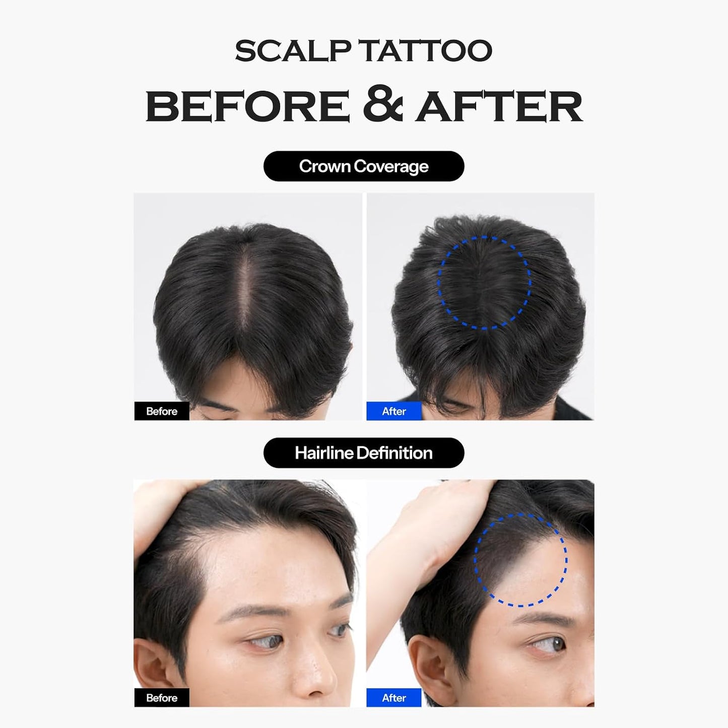 FORBEAUT Scalp Tattoo (Black)