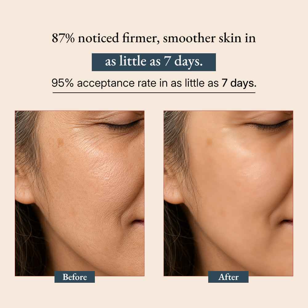 Supercharge Vitamin A Serum - with Bakuchiol Oil (Tridoshic)