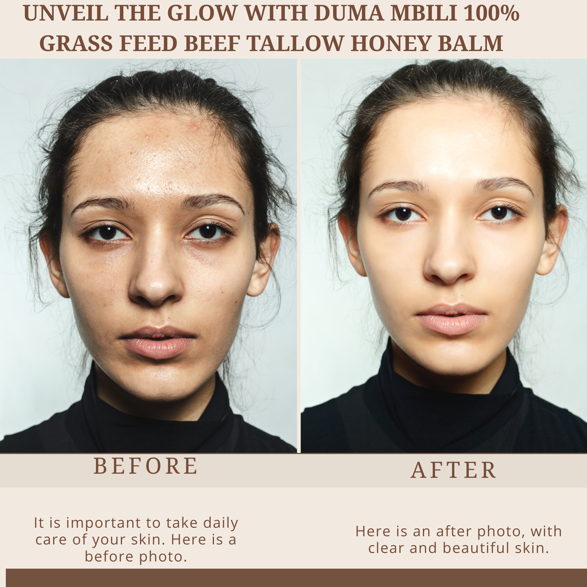 Duma Mbili 100% Grass-Fed Tallow &amp; Honey Balm