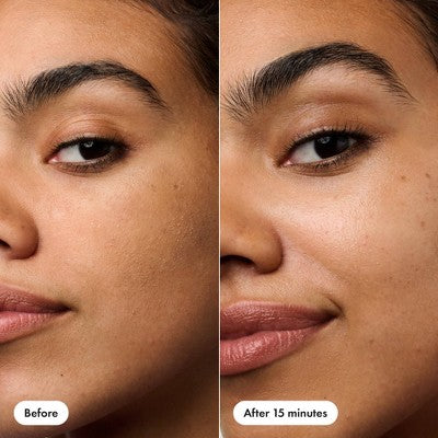 Hero Cosmetics Rescue Patch 6ct - New