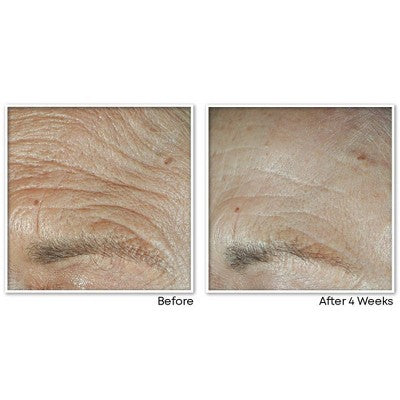 RoC Face & Neck Anti-Aging Moisturizer Firming Cream for Crepey Skin 1.7 fl oz - New