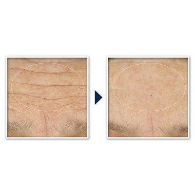 RoC Face & Neck Anti-Aging Moisturizer Firming Cream for Crepey Skin 1.7 fl oz - New