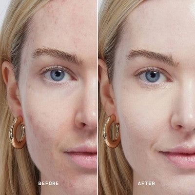 Versed Skin Solution Serum Concealer 2N 0.25 fl oz - New