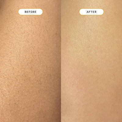 Nood Ingrown Hair Treatment The Eraser - Imperfect Box