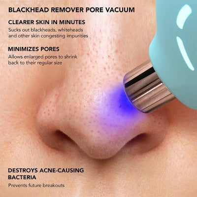FOREO KIWI Skincare Tool - New
