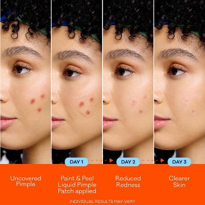 Biore Paint & Peel Liquid Pimple Patch Acne Spot Treatment with Salicylic Acid 0.50oz - Imperfect Box