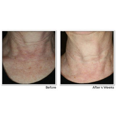 RoC Face & Neck Anti-Aging Moisturizer Firming Cream for Crepey Skin 1.7 fl oz - New