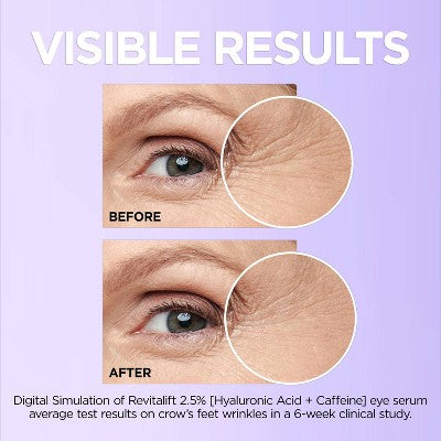 L'Oreal Paris Revitalift Derm Intensives Hyaluronic Acid+Caffeine 0.67 fl oz - Imperfect Box