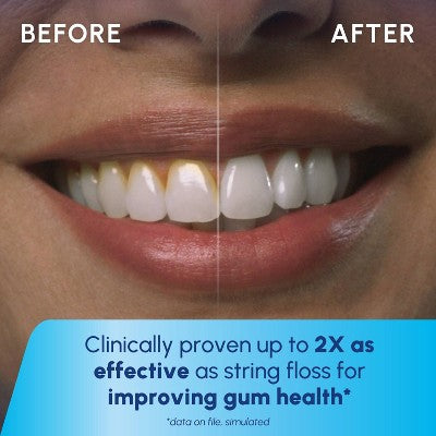 Waterpik Cordless Plus Rechargeable Water Flosser Blue - Imperfect Box