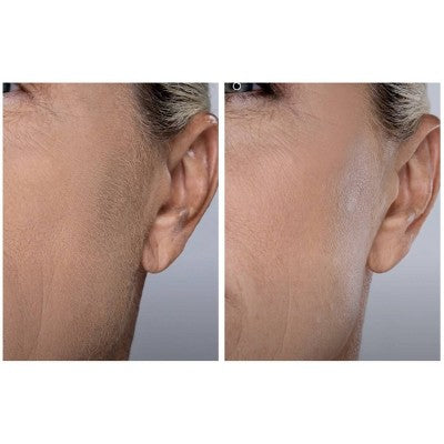 Spa Sciences SIMA Deluxe Sonic Dermaplaning Tool for Exfoliation & Peach Fuzz Removal - Imperfect Box