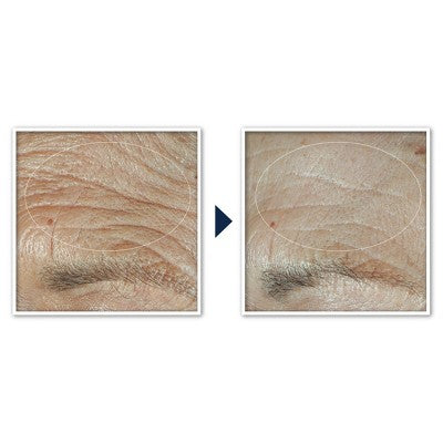 RoC Face & Neck Anti-Aging Moisturizer Firming Cream for Crepey Skin 1.7 fl oz - New