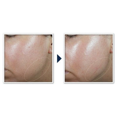 RoC Derm Correxion Contour Cream for Face and Neck 1.7oz - New