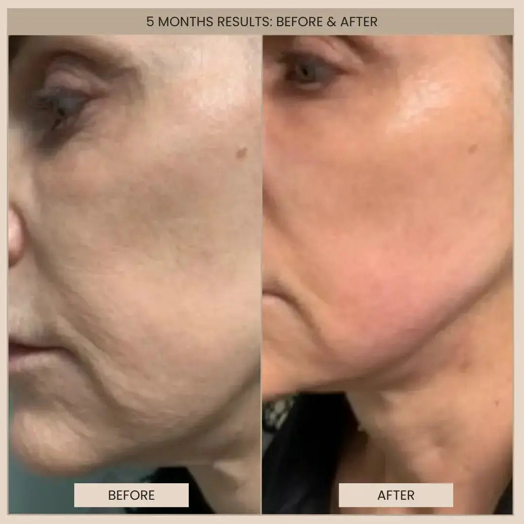 EvenSkyn® Lumo⁺: Premium Anti-Aging & Skin Tightening Handset