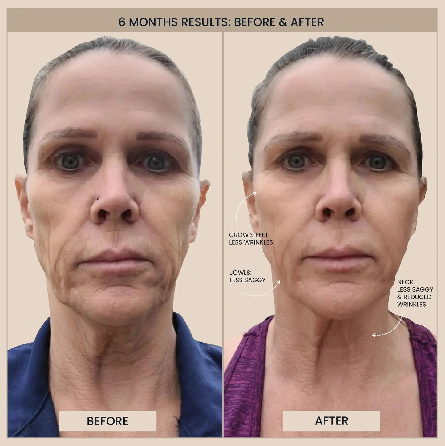 Lumo⁺ + Mirage + Venus: Complete Anti-Aging and Skin Rejuvenation Set