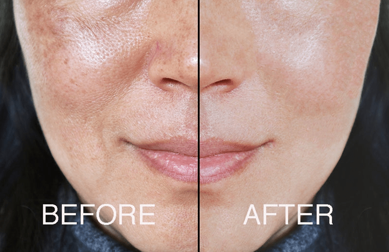 💎 The Complete Fix Youth Serum – Clinical Anti-Aging with Powerful Botanicals